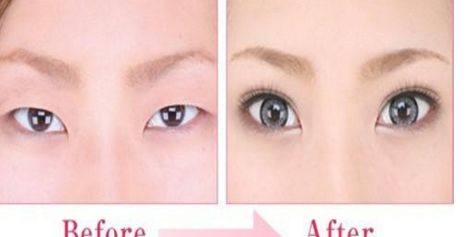 貴陽(yáng)鼻部整形醫(yī)院哪家好？綜合排名及用戶評(píng)價(jià)一覽