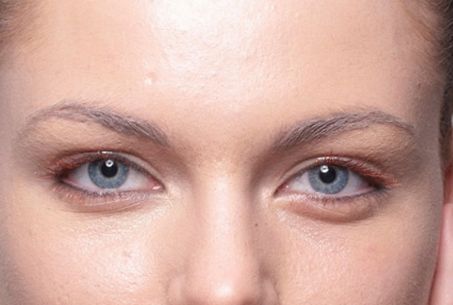 成都有哪些專業(yè)的祛斑祛痘印機構(gòu)值得推薦？