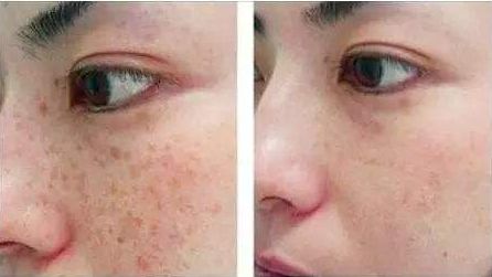 包頭哪家醫(yī)院做隆胸好？全面解析包頭市評(píng)價(jià)最高的隆胸醫(yī)院