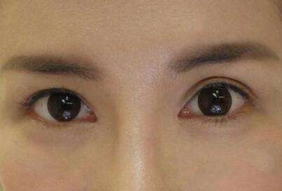 2023杭州自體脂肪豐眉弓正規(guī)專家口碑TOP10強(張常、程磊、黃臺曼口碑擅長、價格簡介盤點)