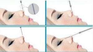 四川哪家醫(yī)院治療狐臭效果好，口碑最佳？