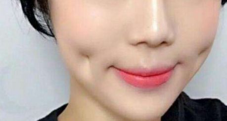 上海超聲刀哪家醫(yī)院做得好？專家推薦，超聲刀手術(shù)最佳選擇