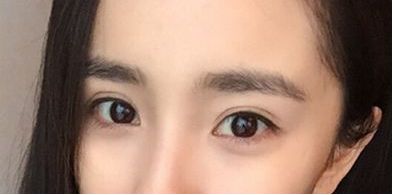 珠海市祛斑好的醫(yī)院哪家靠譜？