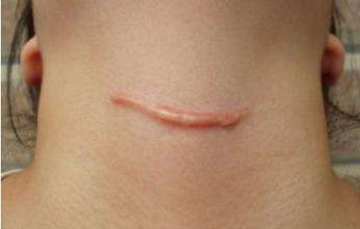 衡陽(yáng)去痘坑哪家醫(yī)院好？-衡陽(yáng)市專業(yè)祛痘修復(fù)醫(yī)院排行榜