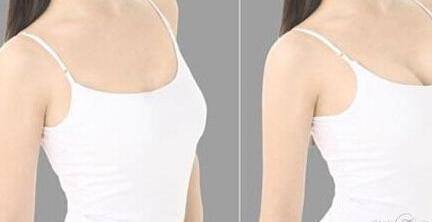 中國醫(yī)科大學(xué)附屬醫(yī)院美容科卓越醫(yī)生名單，親測案例圖詳解！