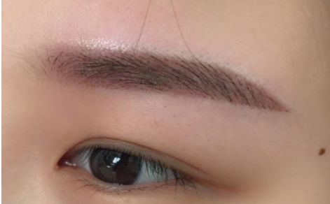 杭州哪家醫(yī)院做隆胸效果好？