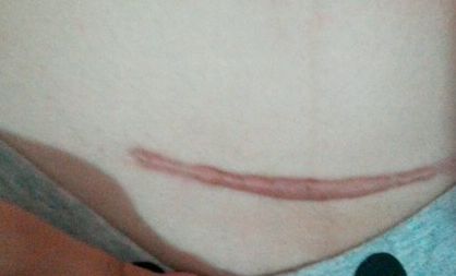 南京激光祛皺紋哪家醫(yī)院好？探尋南京最受歡迎的激光祛皺紋醫(yī)院