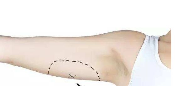 南京去除黃褐斑醫(yī)院排名及口碑，哪家值得信賴？