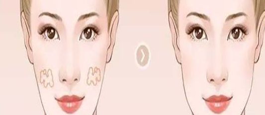 南京哪家醫(yī)院的小陰唇整形效果好？