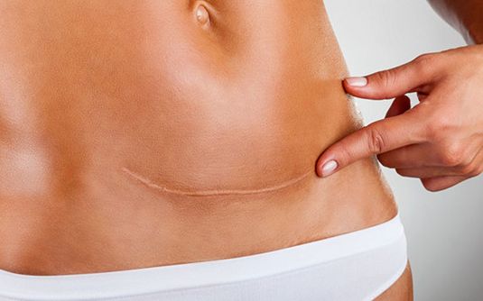 【北京唇裂修復哪家醫(yī)院好？專家推薦權威醫(yī)療機構】