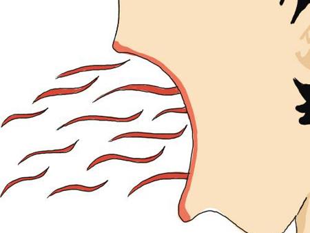 2023常德激光去額頭紋排名前十醫(yī)生(肖興平、李雯、黃先愛明星常去這幾家)