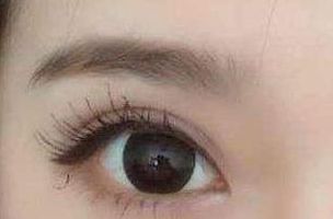 蘇州哪家醫(yī)院的熱瑪吉療效好？