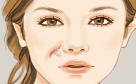 天津有哪些醫(yī)院的祛痘效果好？哪家醫(yī)院的祛痘效果最佳？