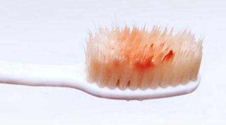 2023蘇州去祛除太田痣口碑榜前10的專家(趙海波、張芮、西會會私立醫(yī)美口碑擅長不同~)