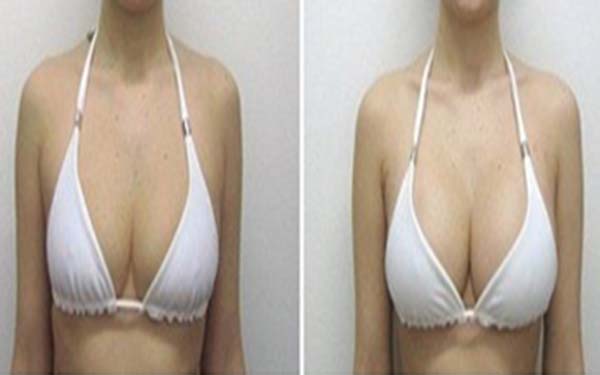 2023臨沂假體鼻子權(quán)威醫(yī)生上榜前十(周新國、崔東、孫慶玉備受好評！)