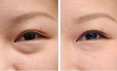 洛陽有減肥醫(yī)院哪家好？瘦身專家推薦幫您選擇洛陽最好的減肥醫(yī)院