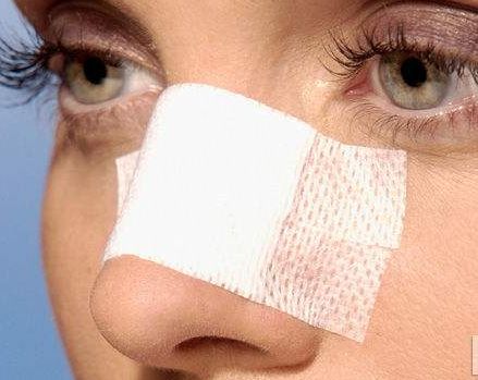 徐州雙眼皮哪家醫(yī)院好？選擇徐州哪家專業(yè)雙眼皮醫(yī)院效果好