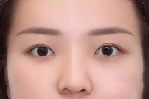 2023長治熱瑪吉祛疤專家推薦前十(田書強、李學雷、董琦這些醫(yī)生更靠譜，更放心！)