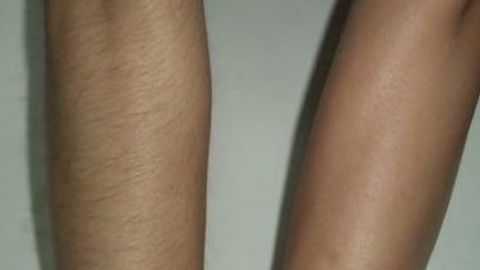 商丘杜韓整形醫(yī)院和華美之間如何選擇？雙眼皮手術(shù)價(jià)格一覽表