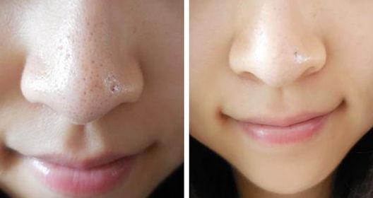 沈陽沈河華顏美整形美容醫(yī)院怎么樣？沈陽沈河華顏美整形美容醫(yī)院簡介|醫(yī)生團隊|口碑評價！