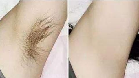 杭州藝星徐利剛醫(yī)生隆鼻項目靠譜嗎？技術操作曝光，口碑如何？