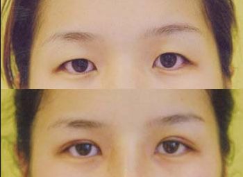 無錫市哪家整形醫(yī)院好？揭秘?zé)o錫地區(qū)口碑最佳整形醫(yī)院！