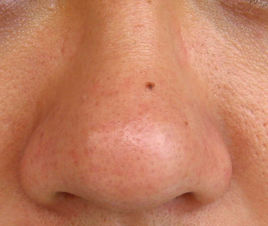 2023重慶內(nèi)路法祛眼袋專家前十強(qiáng)強(qiáng)榜(郭銳、李玲玲、鄭楠專家大咖技術(shù)過(guò)硬)