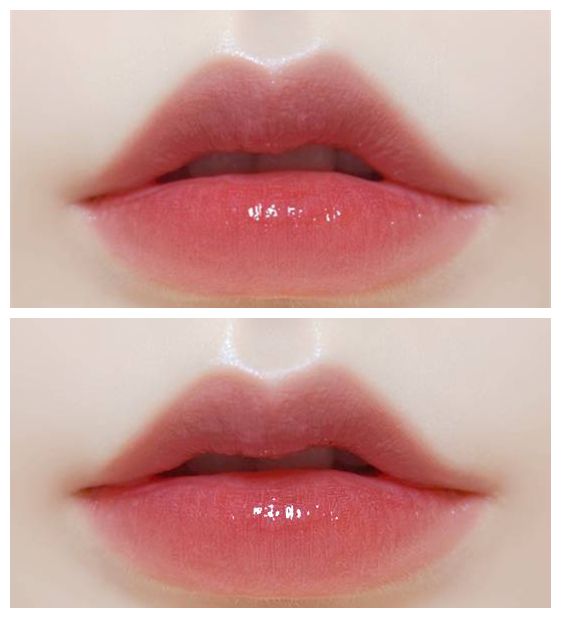 揭秘上海注射玻尿酸醫(yī)院排行榜，哪家好的口碑最高？