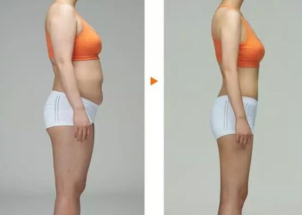 常州去胎記哪家醫(yī)院好？專家推薦常州哪家醫(yī)院胎記治療效果好