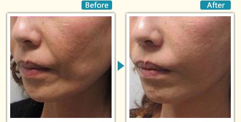 杭州哪家瘦腿針醫(yī)院好？全面解析杭州最受用戶歡迎的瘦腿針醫(yī)院推薦