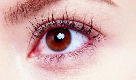 蘇州泰美麗醫(yī)療美容評(píng)價(jià)如何？激光祛斑熱門(mén)醫(yī)生推薦！搖搖欲墜？