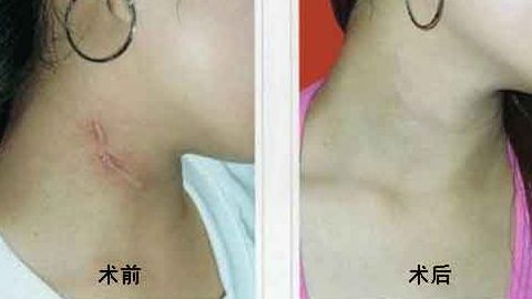 上海中西醫(yī)結合醫(yī)院整形美容科靠譜嗎？聽說口碑不錯！