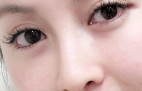 在烏魯木齊有哪些值得推薦的開眼角好醫(yī)院？