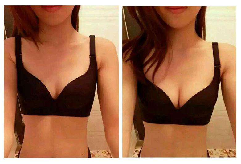 2023義烏生長(zhǎng)紋填充面部皺紋正規(guī)醫(yī)生十強(qiáng)(王馨婉、張喆、高俊明技術(shù)挺靠譜)