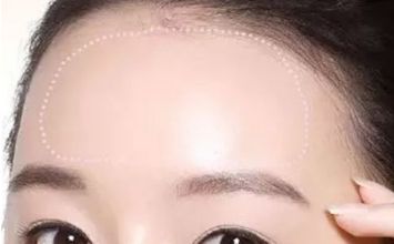 蘇州哪家黃褐斑醫(yī)院好？專(zhuān)業(yè)醫(yī)生推薦，讓你告別黃褐斑困擾！