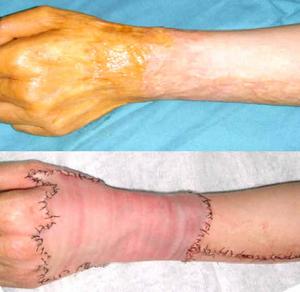 米德傲吸脂技術(shù)優(yōu)勢分析：醫(yī)生評價(jià)、收費(fèi)信息先解密！杭州藝星權(quán)威專家！