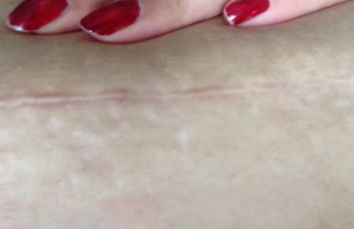 南京哪家醫(yī)院雙眼皮技術(shù)好？醫(yī)生經(jīng)驗豐富，效果一流！