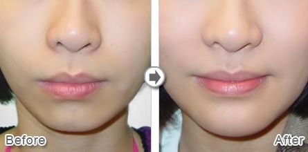 北京腋臭治療好的醫(yī)院有哪些？