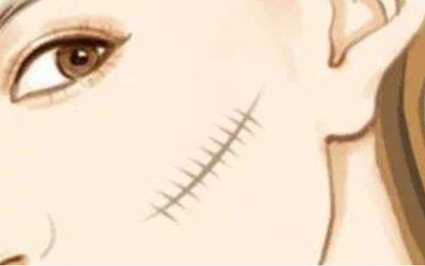 廣州康華清醫(yī)療美容門診部醫(yī)生有哪些擅長項目？醫(yī)院技術(shù)一覽如何？