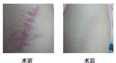 2023西安注射玻尿酸填充顳部正規(guī)專家推薦前十強(王艷娜、賈方艷、欒琪領(lǐng)域廣，涉及項目多！)