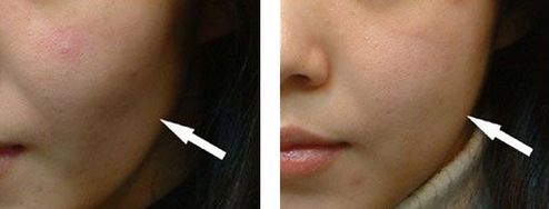 邯鄲美容整形醫(yī)院哪家好？專業(yè)品質(zhì)口碑贊譽(yù)醫(yī)院推薦！