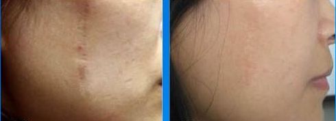 常州拇外翻醫(yī)院哪家醫(yī)院好？專家推薦，附詳細(xì)排名和患者口碑評論