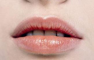 2023寧波玻尿酸去生長(zhǎng)紋正規(guī)醫(yī)生排行榜前十名(陳新平、李鶯、卜雙燕好評(píng)不貴)