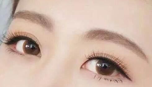 2023廈門眉間紋填充脂肪醫(yī)生評分前10強(魏嘉宏、李國明、李博價格不貴口碑好)