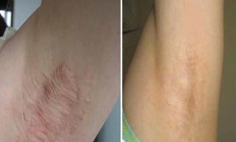 廈門祛雀斑醫(yī)院排名及口碑，哪家好？