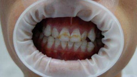 濰坊天宏整形醫(yī)院的口碑好嗎？張明欣技術(shù)擅長(zhǎng)的具體內(nèi)容是什么？?jī)r(jià)目表在文末！