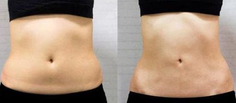 上海疤痕科醫(yī)院哪家好？綜合評(píng)測(cè)2023，含專(zhuān)家問(wèn)答與真實(shí)患者見(jiàn)證