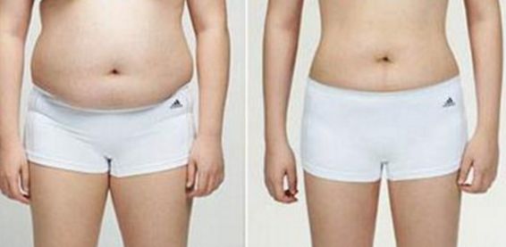 南京哪家醫(yī)院的祛疤效果好，如何選擇南京祛疤醫(yī)院