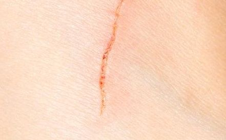 深圳去眼袋醫(yī)院哪家技術先進，效果好