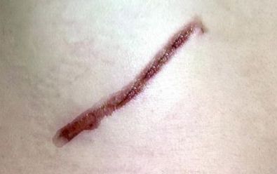 探尋開封市美容醫(yī)院的排名與口碑，哪家值得信賴？